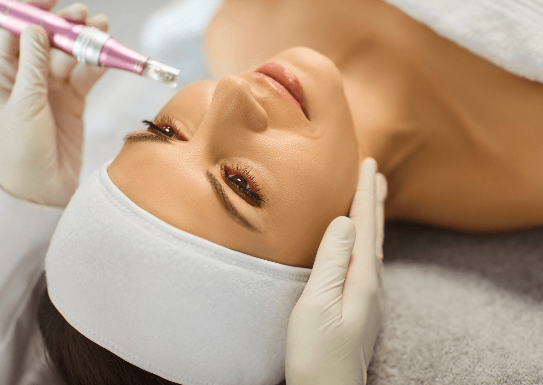 Microneedling